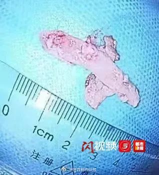 喉骨什么成语_喉骨图片(2)