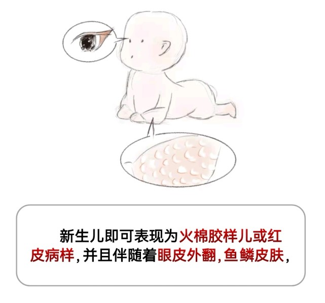 亿分之一顶级罕见病患者被误诊23年后医生说我的病全国只有1例