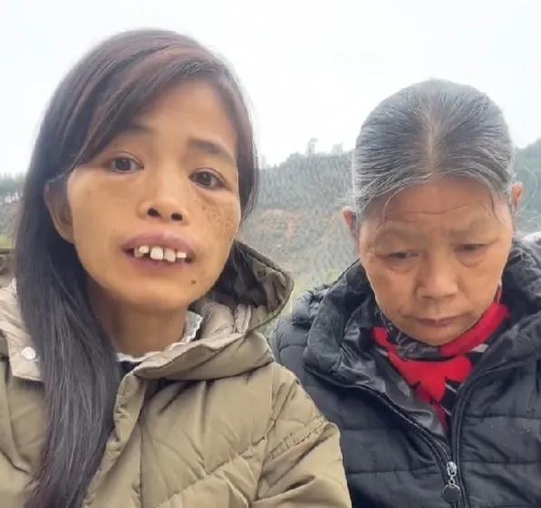 广东女子因长相奇特成大网红一口龅牙无处安放网友抢着要娶她