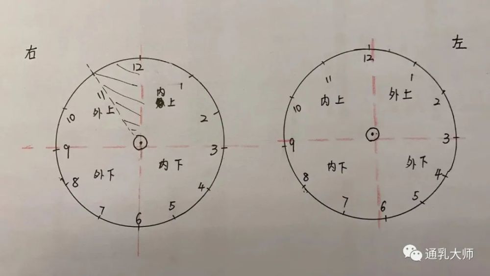 因为乳房是立体的,我们有时候还会说明,某侧乳房几点到几点的位置