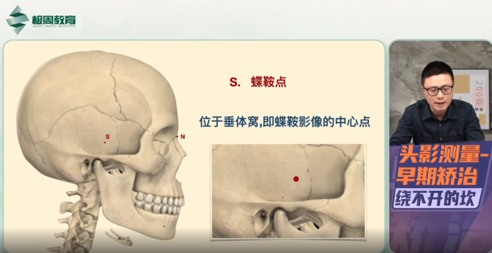 s点 蝶鞍点 :位于垂体窝,即蝶鞍影像的中心点n点 鼻根点:鼻额缝阴影的