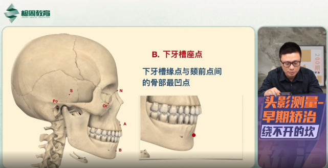 pog点 颏前点:下颌颏部的最突点me点 颏下点:下颌颏部的最下点go点