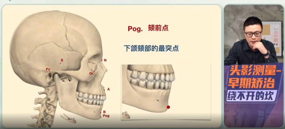 颏下点:下颌颏部的最下点go点:下颌角的后下点ar点 枕骨基部与髁突颈