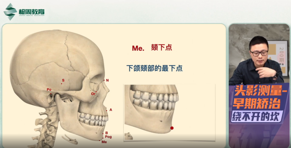 go点:下颌角的后下点ar点 枕骨基部与髁突颈后缘点交点ui点 上中切牙