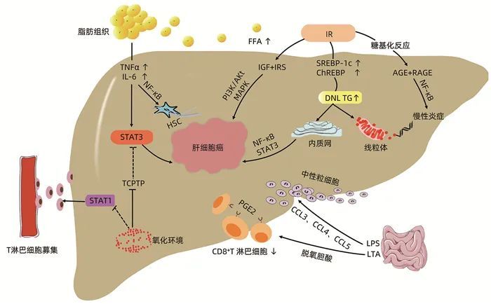 深度综述非酒精性脂肪性肝病相关肝细胞癌的研究进展