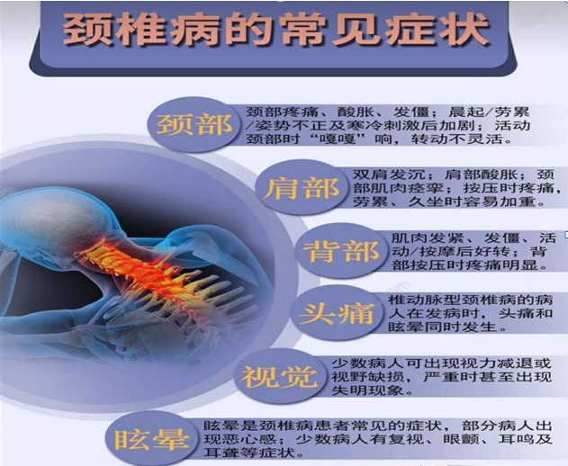 这两种疾病都与颈椎及附近组织长期劳累受损有关,因此出现颈椎疼症状