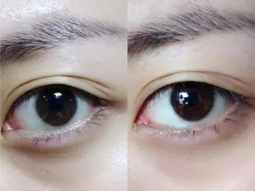 快速缓解视疲劳,还能赶走眼袋,黑眼圈,小细纹,持久水润双眼!_腾讯新闻