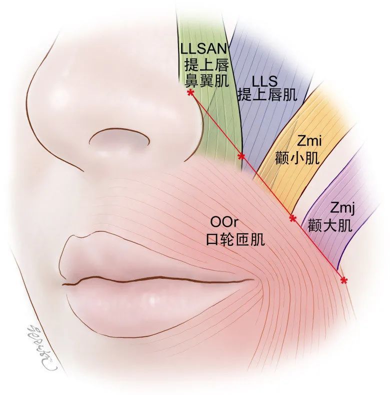 鼻唇沟的分析及美化