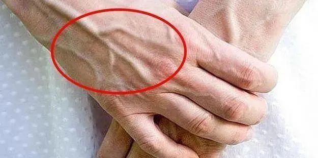 青筋突出 腾讯网