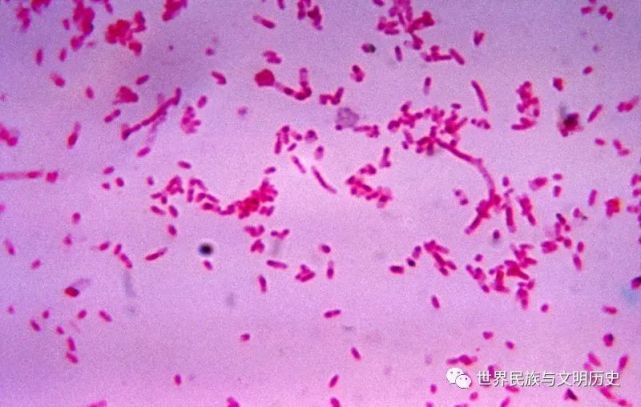 【原核生物全系列-13】细菌界—革兰氏阴性菌