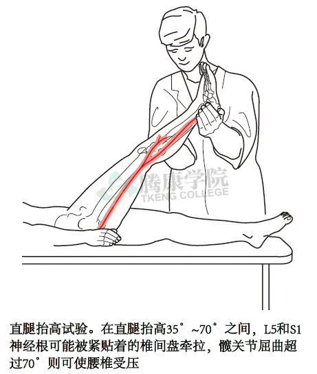 如果患者诉说抬高侧下肢疼痛或麻木感加重,表示直腿抬高