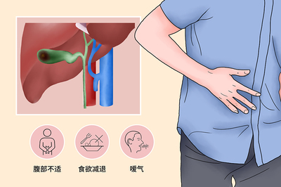 胆囊炎好痛苦别急看这里