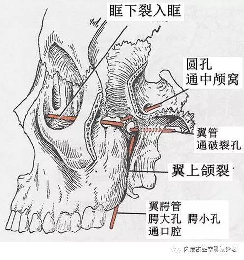 翼腭窝的组成:前壁:上颌窦的后壁后壁:蝶骨大翼前面的下部和翼突根部