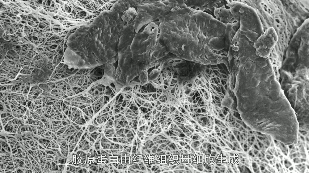 我们在显微镜下能看到,年轻的肌肤是非常紧密的胶原蛋白网络,纤维组织