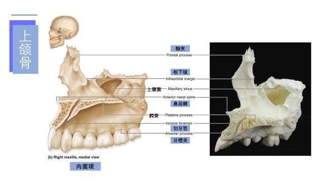 腭骨腭骨(palatinebone)呈l形,位于上颌骨腭突与蝶骨翼突之间,垂直板