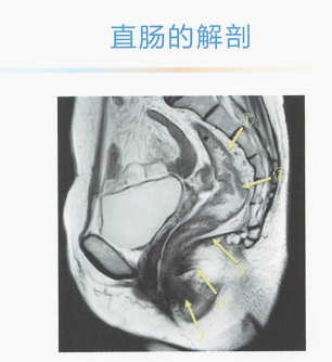 mri丨直肠mri检查技术