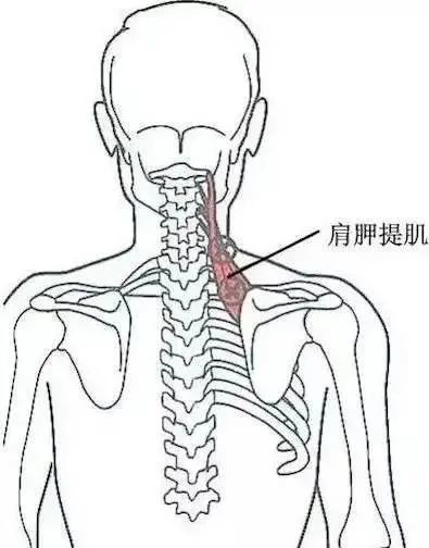 肩胛提肌压痛点肩胛提肌起始于上4个颈椎横突,抵止于肩胛骨内侧角.