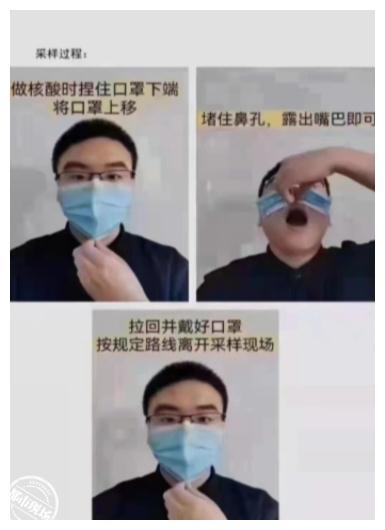 核酸检测采样时,如何正确摘口罩?专家:把口罩往上推不科学