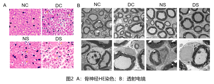 电镜显示nc组坐骨神经髓鞘结构致密,排列整齐规则,dc和ds组髓鞘板层