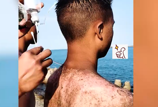 战士们海训皮肤被烈日灼伤,仍不放弃,心疼又骄傲!