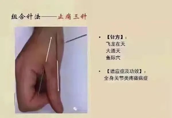 特效陷谷一针即可蹲13 失眠5针:主穴申脉与照海,配头