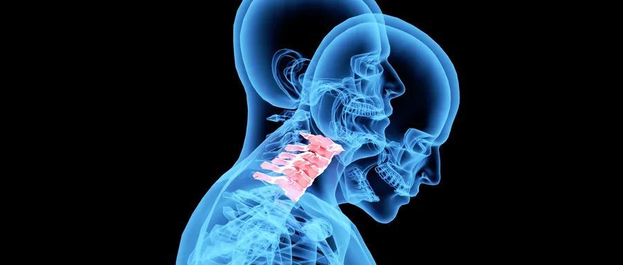 颈椎病到底有多危险这些类型你务必要了解