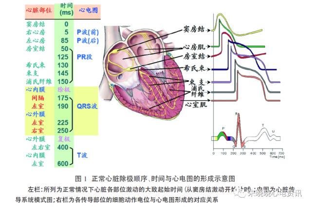 pj间期延长的心室预激