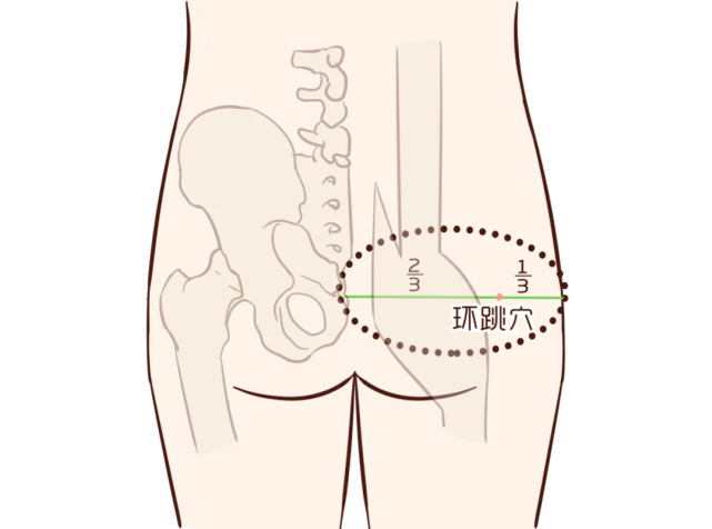 穴位|环跳穴|下肢|梨状肌