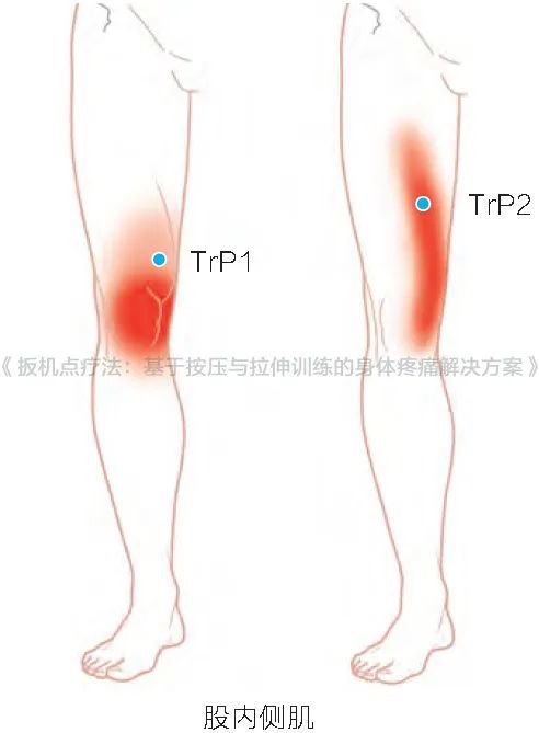扳机点 腾讯网