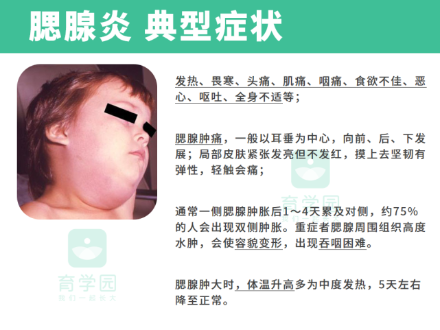 3大传染病来袭!这1招预防最有效!