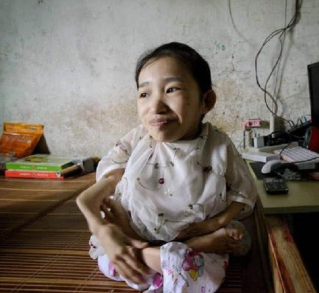 重庆女子生三个"盆栽娃",翻身都骨折,又坚持生4胎,过得如何