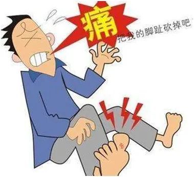 难以承受之痛——痛风