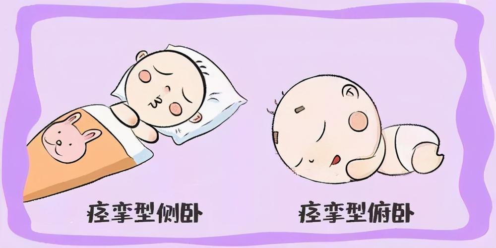 梁锦平医生给大家介绍小儿脑瘫的危害