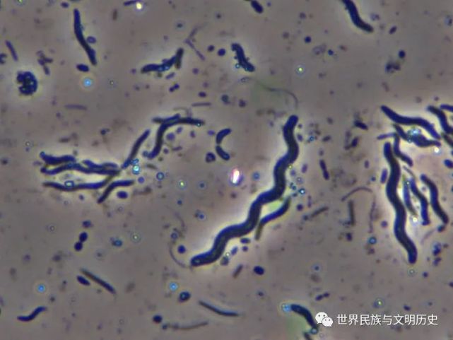 嘉利翁氏菌科(gallionellaceae)下属科:亚硝化单胞菌目(学名:nitroso