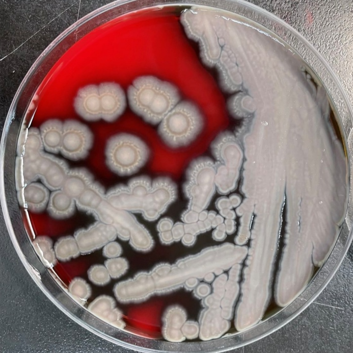 笔者所读的微生物教材中,就有提到肺炎链球菌r-s转化实验,s型菌细胞膜