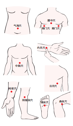 注:穴位位置气海:人体前正中线上,脐下1.5寸.