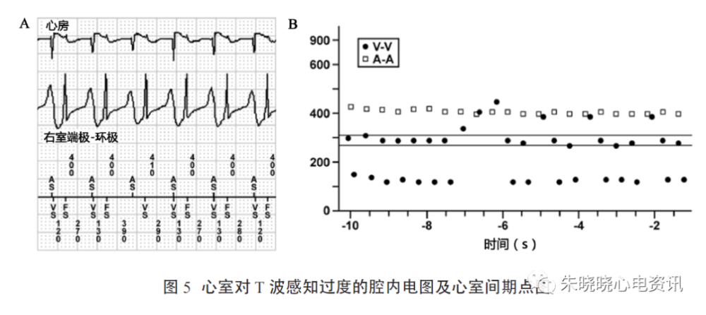 icd感知功能障碍及处理一