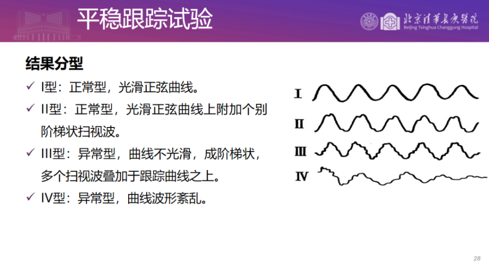 临床听力学技术专业沙龙梁思超浅析眼震视图的操作要点