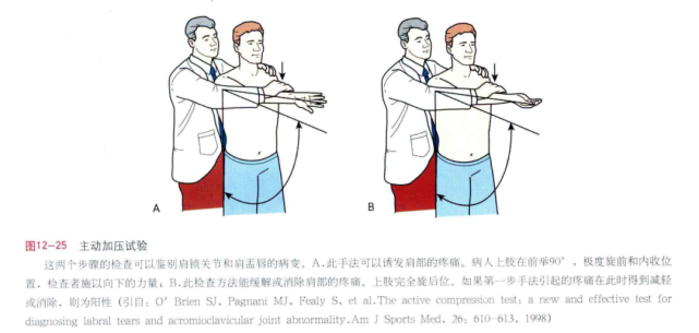 干货|肩锁关节的定位和激发疼痛的检查方法