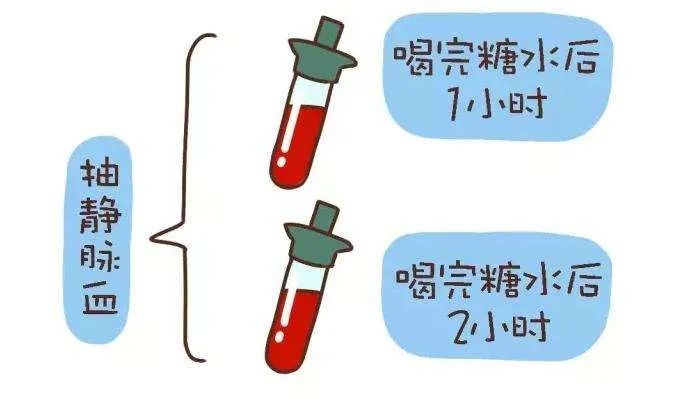 先测空腹血糖,抽完空腹血以后,立刻喝75g葡萄糖水,葡萄糖水要在五分钟