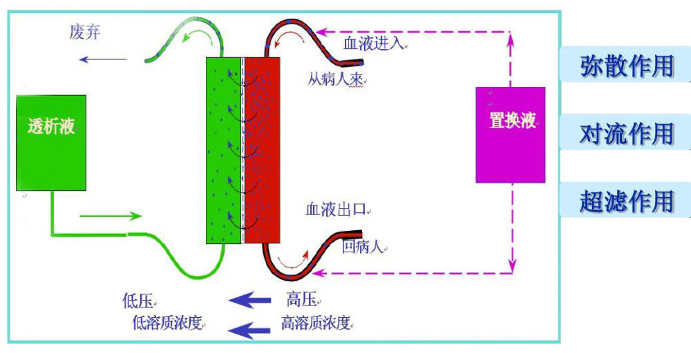 血液滤过血液灌流血液透析滤过三者区别作用