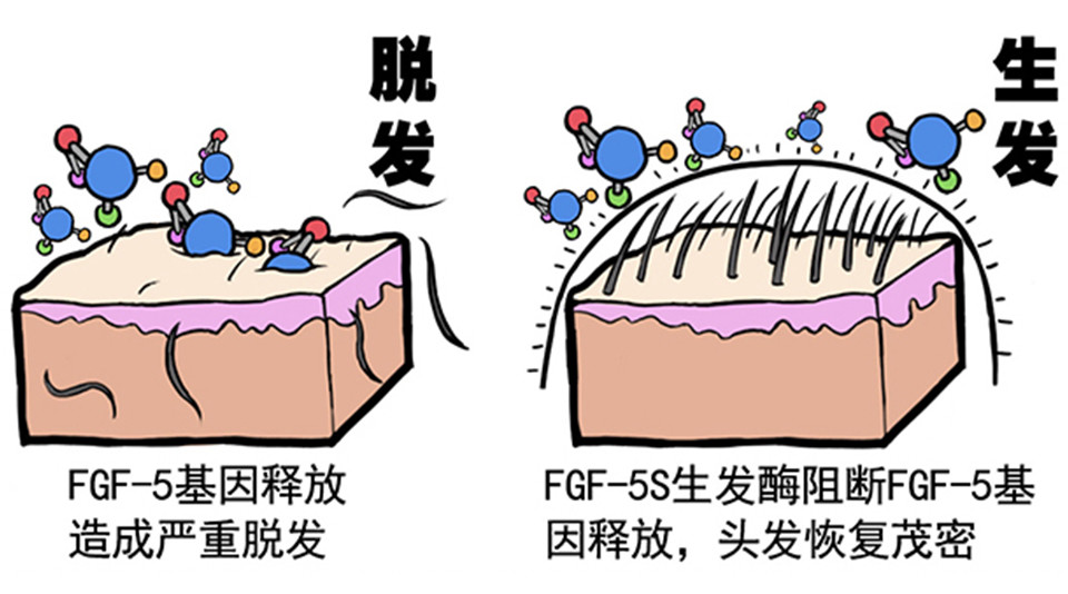 头发总是掉汗毛却越来越旺盛这是咋回事