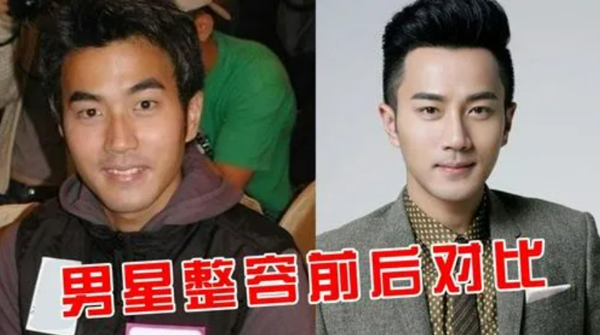8位改头换命的男明星王一博脸已僵硬刘恺威眼皮才是灵魂