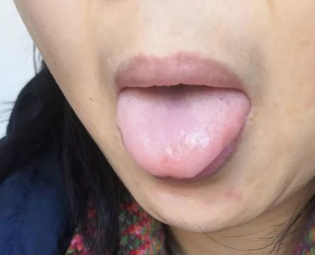 从一例贫血案例探讨"治病求本"
