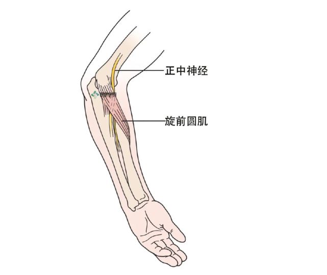 正中神经应用解剖