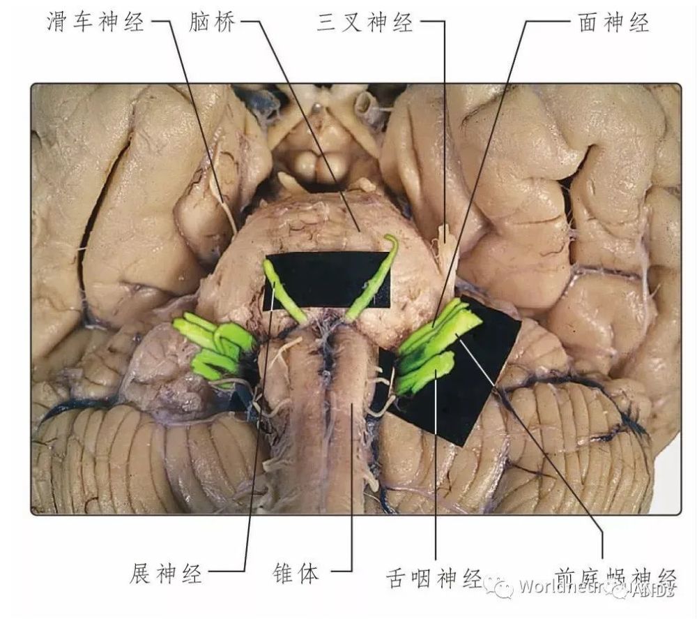 彩图经典版│脑神经和脑神经核解剖