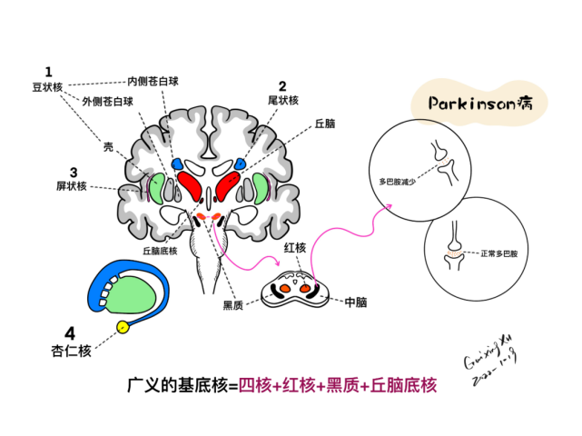 四核 红核 黑质 丘脑底核冠状位:基底核与丘脑,脑室的位置