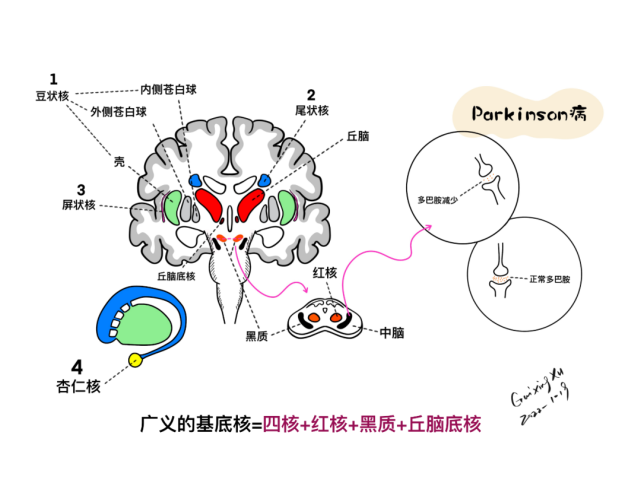 广义的基底核 = 四核   红核   黑质   丘脑底核冠状位:基底核与丘脑