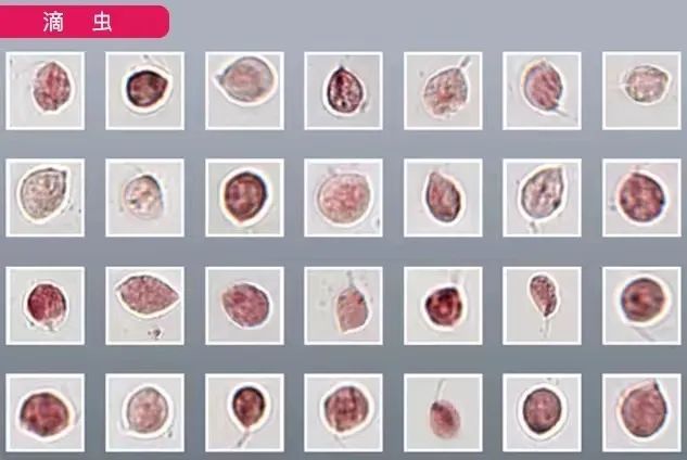 微生态评价——阴道感染性疾病诊治新思路