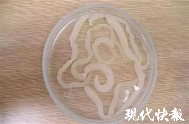 男子眼球中取出一条6厘米长活虫|裂头蚴|眼球|绦虫|曼氏